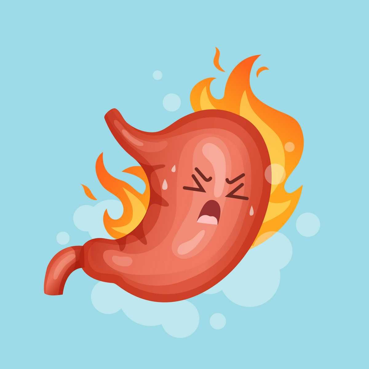 Surgical treatments for Heartburn and Esophageal Reflux